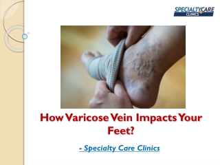 Varicose Veins - Causes, Symptoms and Treatment