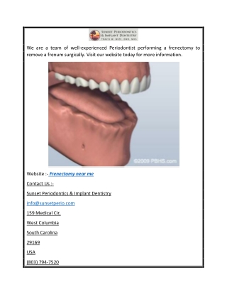 Frenectomy Near Me  Columbiascperiodontist.com