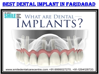 To Get Best Dental Implant Clinic in Faridabad Visit Here