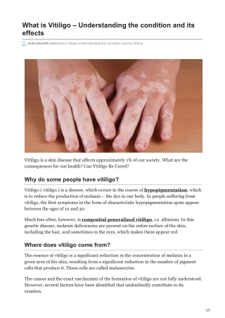 What is Vitiligo  Understanding the condition and its effects