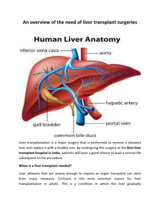 An overview of the need of liver transplant surgeries