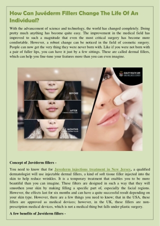 How Can Juvéderm Fillers Change The Life Of An Individual