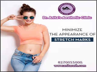 dr. anita rath is best lady cosmetologist for stretch mark remove treatment in bhubaneswar, odisha.