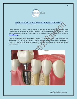 How to Keep Your Dental Implants Clean?
