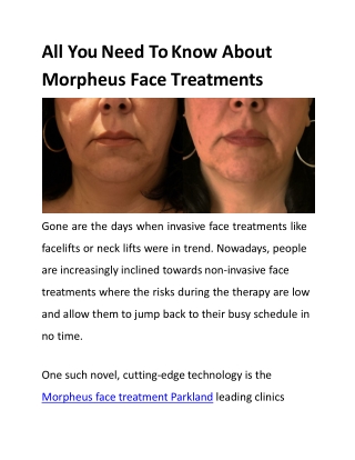 All You Need To Know About Morpheus Face Treatments-converted