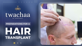 Necessary Steps before a Hair Transplant