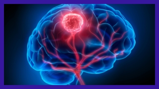 Best Brain Tumor