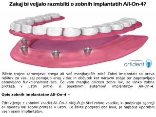 Zakaj bi veljalo razmisliti o zobnih implantatih All-On-4?