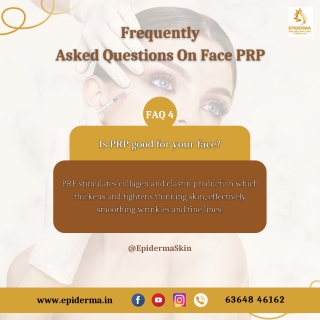 Is PRP good for your face | Best Skin Clinic in Bangalore | Epiderma Clinic