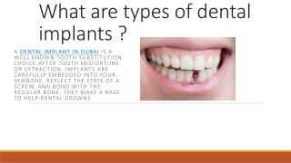 dental implant
