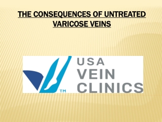The Consequences of Untreated Varicose Veins