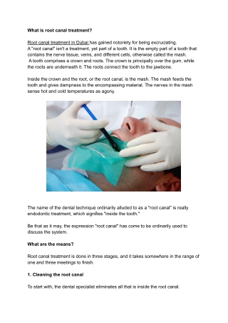 Everything you Need To Know About Root Canal Treatment