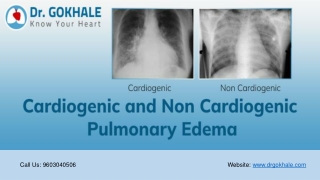 Cardiogenic and Non Cardiogenic Pulmonary Edema | Dr Gokhale