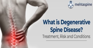 What is Degenerative Spine Disease? Treatment, Risk and Conditions | Mehta Spine