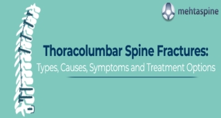 Thoracolumbar Spine Fractures_ Types, Causes, Symptoms and Treatment Options pptx