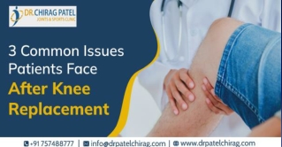 3 Common Issues Patients Face After Knee Replacement |Dr.Chirag Patel