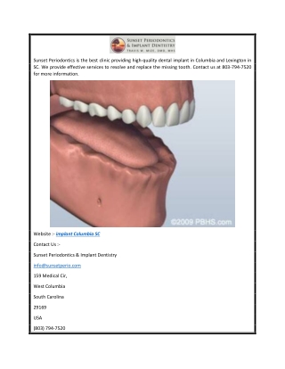 implant Columbia SC  Columbiascperiodontist.com
