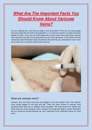 What Are The Important Facts You Should Know About Varicose Veins