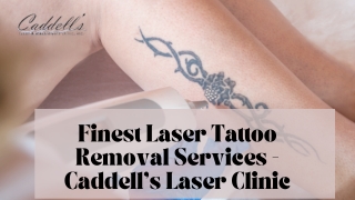 Finest Laser Tattoo Removal Services - Caddell's Laser Clinic
