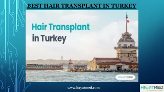 Best Hair Transplant In Turkey | HayatMed Clinic