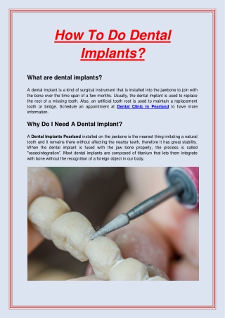 How To Do Dental Implants