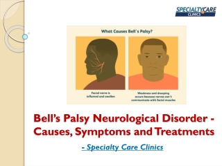Bell’s Palsy Neurological Disorder - Causes, Symptoms and Treatments