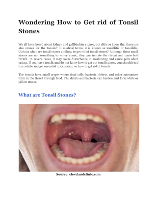 Wondering How to Get rid of Tonsil Stones