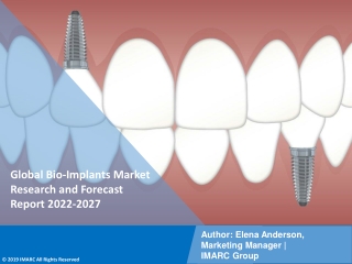 Bio-Implants Market PDF: Research Report, Share, Size, Trends, Forecast by 2027