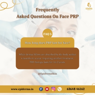 How long does PRP last for face - Skin Clinic in Jayanagar - Epiderma Clinic