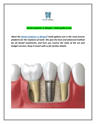 Dental Implants In Bhopal | Smile-gallery.com