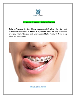 braces cost in bhopal | Smile-gallery.com
