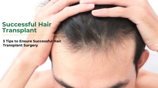 3 Tips to Ensure Successful Hair Transplant Surgery