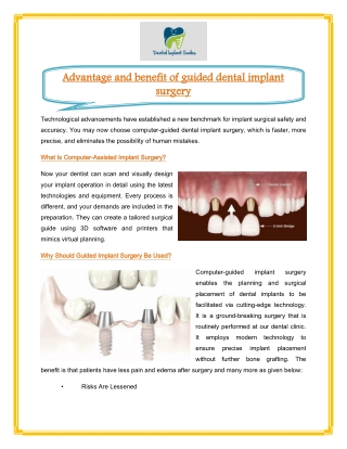 Advantage and benefit of guided dental implant surgery
