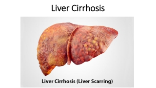 Treatment For Liver Cirrhosis