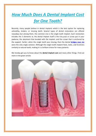 How Much Does A Dental Implant Cost for One Tooth
