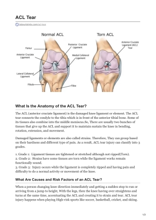 ACL Tear in jaipur