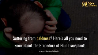 Suffering from baldness Here’s all you need to know about the Procedure of Hair Transplant!