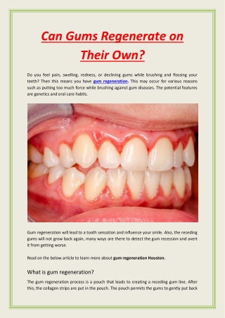 Can Gums Regenerate on Their Own