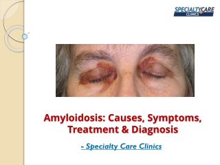 Amyloidosis - Causes, Symptoms, Treatment & Diagnosis