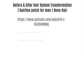 Before & After Hair System Transformation | Hairline patch for men | Bono Hair