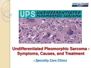 Undifferentiated Pleomorphic Sarcoma - Symptoms, Causes, and Treatment