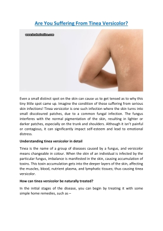 Are You Suffering From Tinea Versicolor