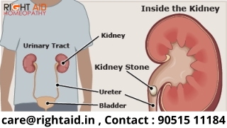 Most Efficient Homeopathic Medicine For Kidney Stones