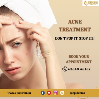 Acne Treatment - Best Skin Clinic in Jayanagar, Bangalore - Epiderma Clinic