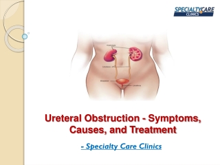 Ureteral Obstruction - Symptoms, Causes, and Treatment
