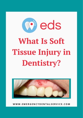 What Is Soft Tissue Injury in Dentistry? | Emergency Dental Service