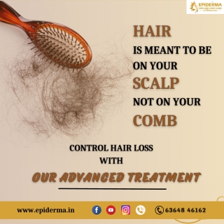 Control your hair loss | Best Hair loss treatment in Jayanagar | Epiderma Clinic