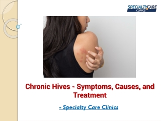 Chronic Hives - Symptoms, Causes, and Treatment