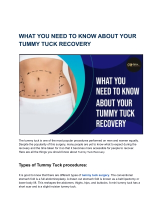WHAT YOU NEED TO KNOW ABOUT YOUR TUMMY TUCK RECOVERY