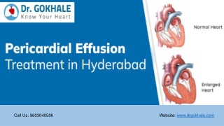 Pericardial Effusion Treatment in Hyderabad | Dr Gokhale